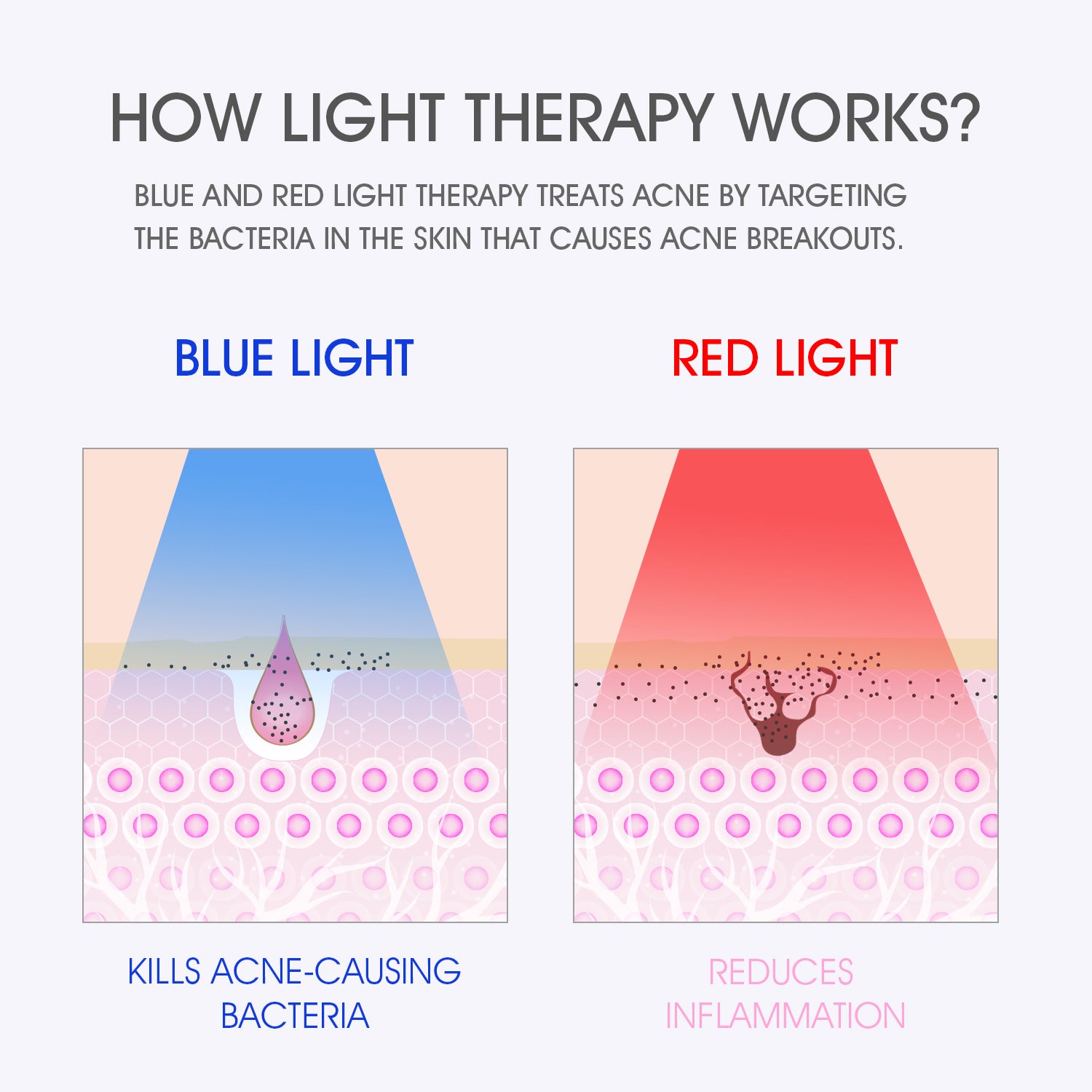 FT330 Light Therapy Treatment Mask